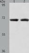 Acyl-CoA Thioesterase 11 antibody, TA322345, Origene, Western Blot image 