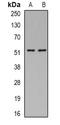 Argininosuccinate lyase antibody, orb341048, Biorbyt, Western Blot image 