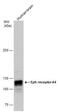 EPH Receptor A4 antibody, PA5-27998, Invitrogen Antibodies, Western Blot image 