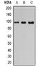 PDE6B antibody, orb341201, Biorbyt, Western Blot image 