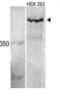 Histone-lysine N-methyltransferase MLL3 antibody, abx032715, Abbexa, Immunohistochemistry paraffin image 