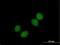 Choline Kinase Beta antibody, H00001120-B01P, Novus Biologicals, Immunocytochemistry image 