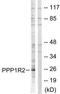 Protein phosphatase inhibitor 2 antibody, TA314369, Origene, Western Blot image 