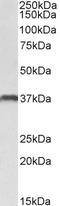 CLEC12A antibody, TA329092, Origene, Western Blot image 