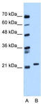 RAB11B, Member RAS Oncogene Family antibody, TA346586, Origene, Western Blot image 