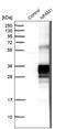 NFAT Activating Protein With ITAM Motif 1 antibody, PA5-56866, Invitrogen Antibodies, Western Blot image 