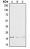 Cardiotrophin-1 antibody, orb213798, Biorbyt, Western Blot image 