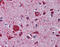 LDL Receptor Related Protein 8 antibody, 26-001, ProSci, Immunohistochemistry paraffin image 