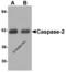 Caspase 2 antibody, 3447, ProSci Inc, Western Blot image 