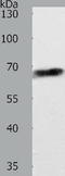 ATP Binding Cassette Subfamily D Member 4 antibody, TA322672, Origene, Western Blot image 