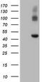 Carboxypeptidase A2 antibody, M06401, Boster Biological Technology, Western Blot image 