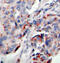 Janus Kinase 2 antibody, abx000422, Abbexa, Immunohistochemistry frozen image 