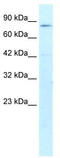 Activating Transcription Factor 6 Beta antibody, TA330184, Origene, Western Blot image 
