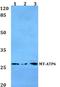 Mitochondrially Encoded ATP Synthase Membrane Subunit 6 antibody, A02081, Boster Biological Technology, Western Blot image 