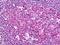 Ubiquilin 1 antibody, orb95208, Biorbyt, Immunohistochemistry paraffin image 