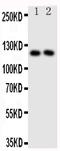 Neuropilin 1 antibody, PA1752, Boster Biological Technology, Western Blot image 