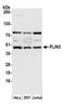 PP17 antibody, A305-338A, Bethyl Labs, Western Blot image 