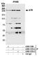 Serine/threonine-protein kinase ATR antibody, A300-137A, Bethyl Labs, Immunoprecipitation image 