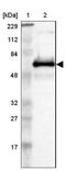 ETS Variant 3 antibody, NBP1-80931, Novus Biologicals, Western Blot image 
