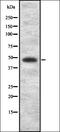 Cholinergic Receptor Nicotinic Alpha 3 Subunit antibody, orb337298, Biorbyt, Western Blot image 