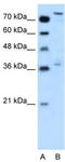 Nuclear Factor, Erythroid 2 Like 3 antibody, TA334238, Origene, Western Blot image 