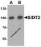 SID1 transmembrane family member 2 antibody, 7159, ProSci Inc, Western Blot image 