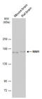 Regulating Synaptic Membrane Exocytosis 1 antibody, GTX134539, GeneTex, Western Blot image 