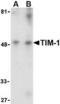 Kim1 antibody, TA306321, Origene, Western Blot image 