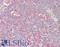 Actin Related Protein 2/3 Complex Subunit 3 antibody, LS-C211593, Lifespan Biosciences, Immunohistochemistry paraffin image 