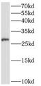 Ankyrin Repeat Domain 49 antibody, FNab00414, FineTest, Western Blot image 