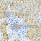 EGFR antibody, A2909, ABclonal Technology, Immunohistochemistry paraffin image 