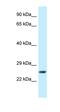 Galanin Receptor 2 antibody, orb331130, Biorbyt, Western Blot image 
