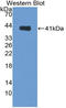 Neutrophil defensin 4 antibody, LS-C314975, Lifespan Biosciences, Western Blot image 