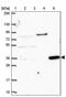 CLN6 Transmembrane ER Protein antibody, PA5-64260, Invitrogen Antibodies, Western Blot image 