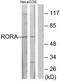 Nuclear receptor ROR-alpha antibody, TA314450, Origene, Western Blot image 