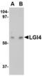 Leucine-rich repeat LGI family member 4 antibody, TA306545, Origene, Western Blot image 