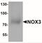 NADPH Oxidase 3 antibody, NBP2-41292, Novus Biologicals, Western Blot image 