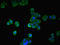 Peptidyl Arginine Deiminase 2 antibody, orb243150, Biorbyt, Immunofluorescence image 