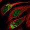 Zinc Finger Protein 398 antibody, NBP2-57260, Novus Biologicals, Immunocytochemistry image 