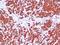 Keratin 77 antibody, M14209-2, Boster Biological Technology, Immunohistochemistry paraffin image 