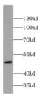 COP9 Signalosome Subunit 2 antibody, FNab01870, FineTest, Western Blot image 