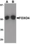 Forkhead Box O4 antibody, PA5-20975, Invitrogen Antibodies, Western Blot image 
