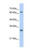 Inactive ubiquitin-specific peptidase 39 antibody, NBP1-80313, Novus Biologicals, Western Blot image 