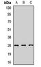 Small Nuclear Ribonucleoprotein Polypeptide A' antibody, LS-C668073, Lifespan Biosciences, Western Blot image 