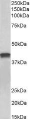 Troponin T2, Cardiac Type antibody, STJ73130, St John