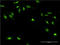 Gigaxonin antibody, LS-C198530, Lifespan Biosciences, Immunofluorescence image 