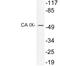 Carbonic Anhydrase 9 antibody, LS-C177312, Lifespan Biosciences, Western Blot image 