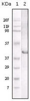 LIPA antibody, abx011099, Abbexa, Enzyme Linked Immunosorbent Assay image 