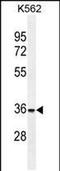 Forkhead Box I3 antibody, PA5-48217, Invitrogen Antibodies, Western Blot image 