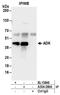 Adenosine Kinase antibody, A304-280A, Bethyl Labs, Immunoprecipitation image 